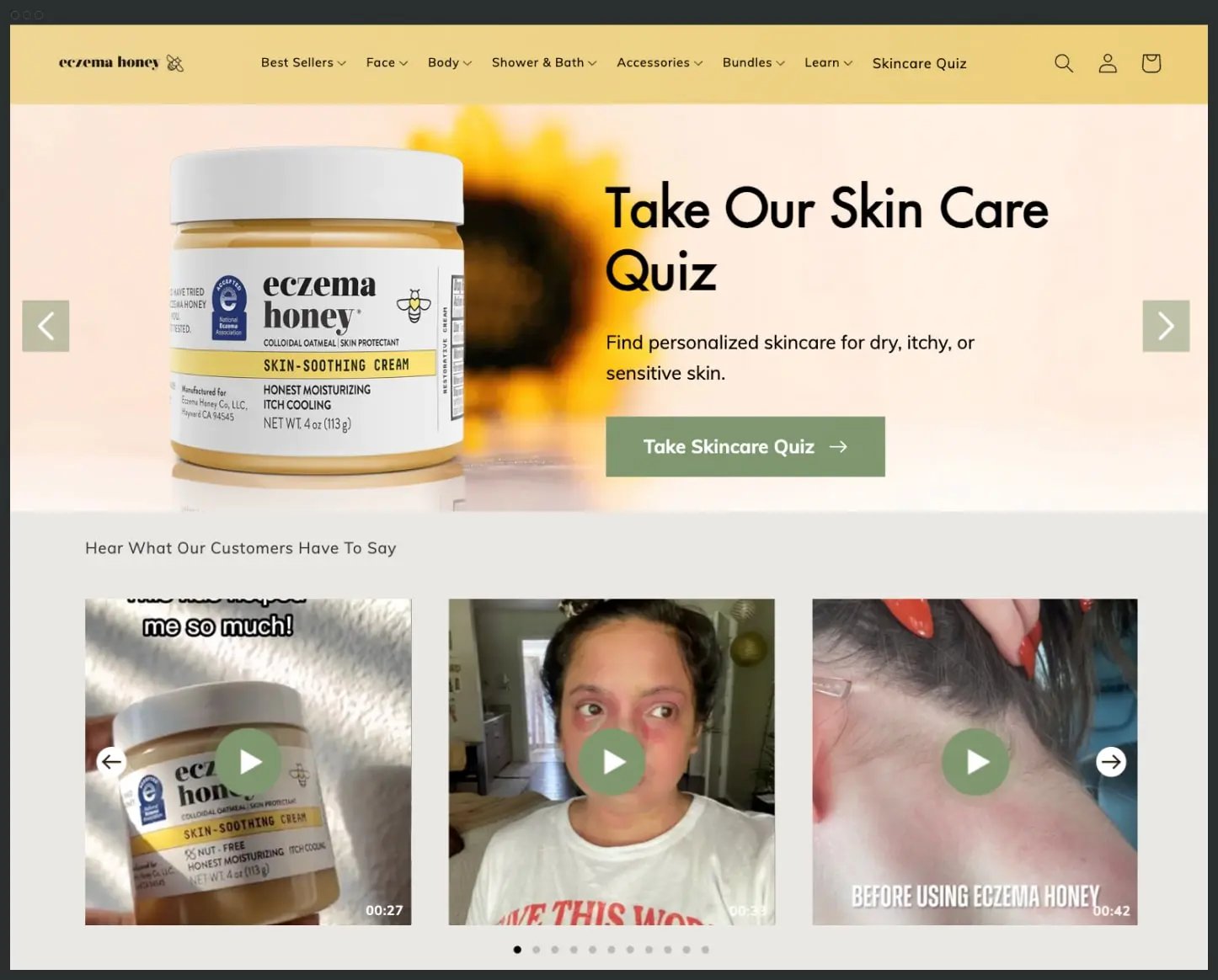 Shopify shoppable video Eczema Honey