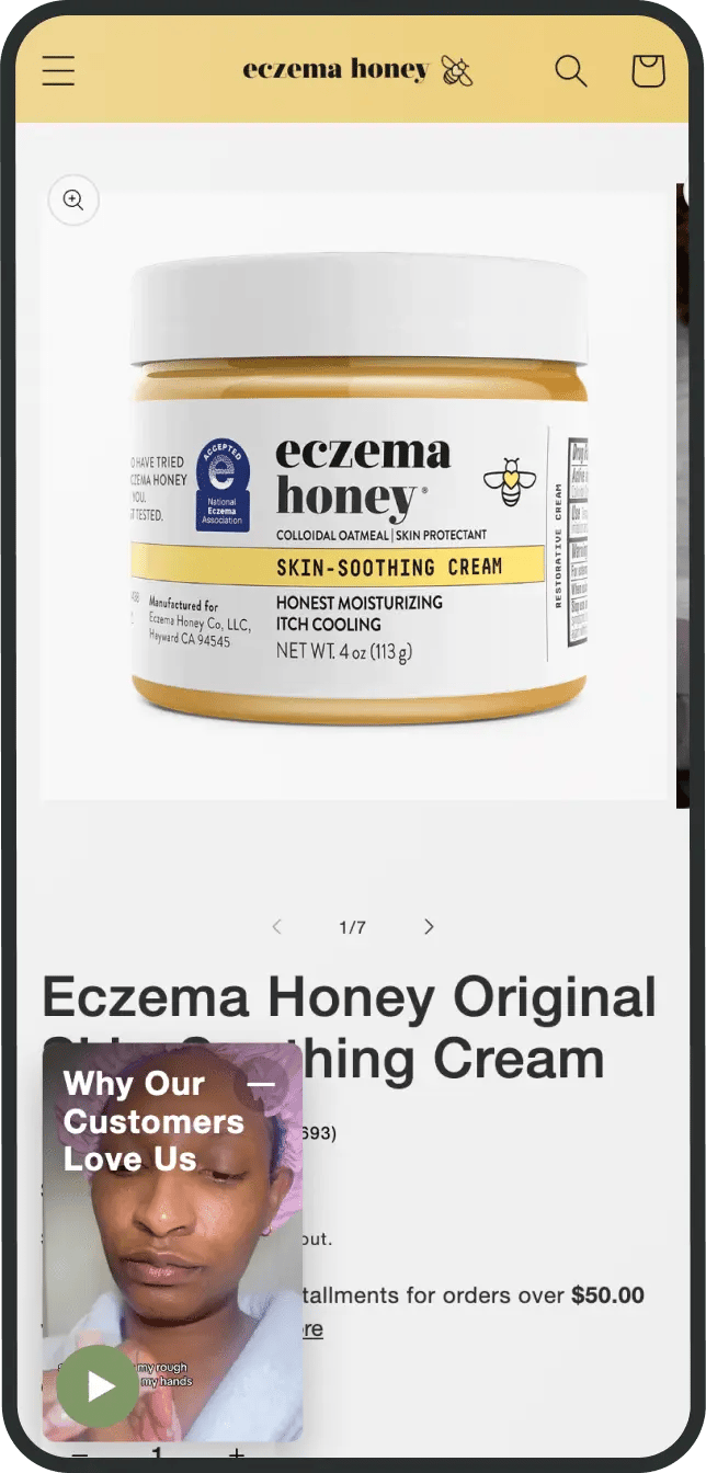 Shopify shoppable video Eczema Honey
